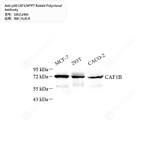 Антитела первичные, поликлональные кролика к p60 CAF1/MPP7 крысы, мыши, человека, 50 мкл