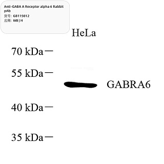 Антитела первичные, поликлональные кролика к GABA A Receptor alpha 6 человека, 100 мкл