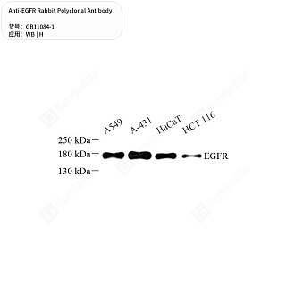 Антитела первичные, поликлональные кролика к EGFR человека, 50 мкл