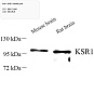 Антитела первичные, поликлональные, KSR1, 100 мкл