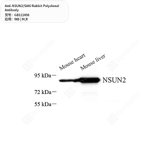 Антитела первичные, поликлональные кролика к NSUN2/SAKI крысы, мыши, 50 мкл