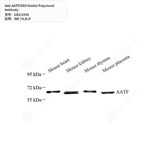 Антитела первичные, поликлональные кролика к AATF/DED крысы, мыши, человека, 50 мкл