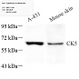 Антитела первичные, поликлональные, Cytokeratin 5, 100 мкл