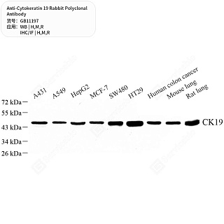 Антитела первичные, поликлональные кролика к Cytokeratin 19 крысы, мыши, человека, 50 мкл