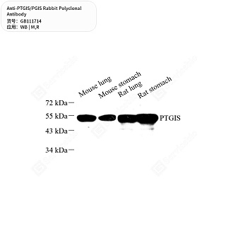 Антитела первичные, поликлональные кролика к PTGIS/PGIS крысы, мыши, 50 мкл