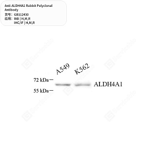 Антитела первичные, поликлональные кролика к ALDH4A1 крысы, мыши, человека, 50 мкл