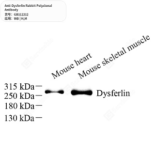 Антитела первичные, поликлональные кролика к Dysferlin мыши, человека, 50 мкл