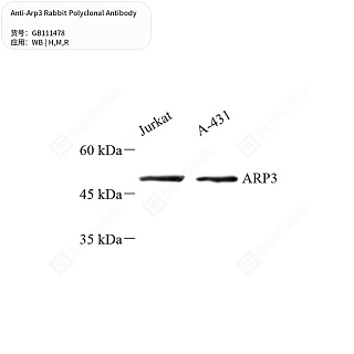 Антитела первичные, поликлональные кролика к Arp3 крысы, мыши, человека, 50 мкл