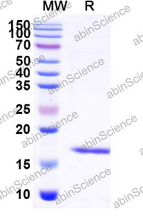 Наноантитела Albumin/HSA (SAA0807), 100 мкг