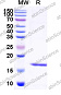 Наноантитела Albumin/HSA (SAA0807), 100 мкг