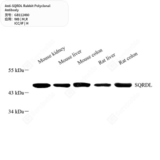 Антитела первичные, поликлональные кролика к SQRDL крысы, мыши, человека, 50 мкл