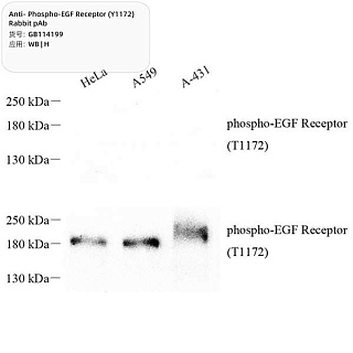 Антитела первичные, поликлональные кролика к Phospho-EGF Receptor (Y1172) человека, 100 мкл