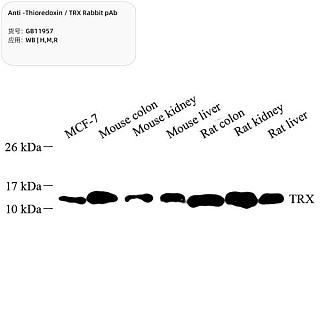 Антитела первичные, поликлональные кролика к Thioredoxin/TRX крысы, мыши, человека, 100 мкл