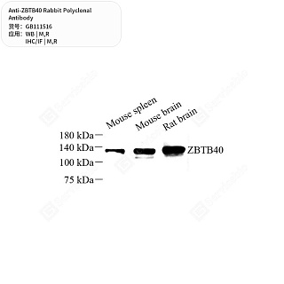 Антитела первичные, поликлональные кролика к ZBTB40 крысы, мыши, 50 мкл