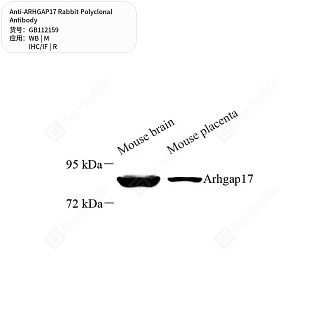 Антитела первичные, поликлональные кролика к ARHGAP17 крысы, мыши, 50 мкл