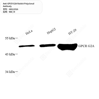 Антитела первичные, поликлональные кролика к GPCR G2A человека, 50 мкл