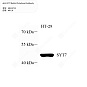 Антитела первичные, поликлональные кролика к SYT7 человека, 50 мкл
