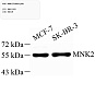 Антитела первичные, поликлональные, MNK2, 100 мкл