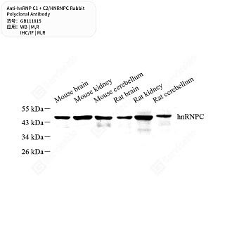 Антитела первичные, поликлональные кролика к hnRNP C1 + C2/HNRNPC крысы, мыши, 50 мкл