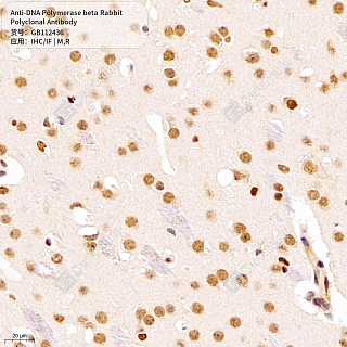 Антитела первичные, поликлональные кролика к DNA Polymerase beta крысы, мыши, 50 мкл