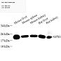 Антитела первичные, поликлональные, GPX1, 100 мкл