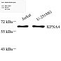 Антитела первичные, поликлональные, KPNA4, 100 мкл