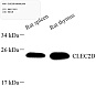 Антитела первичные, поликлональные, CLEC2D, 100 мкл