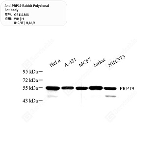 Антитела первичные, поликлональные кролика к PRP19 крысы, мыши, человека, 50 мкл