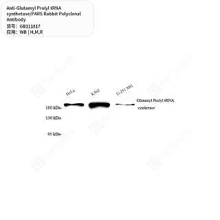 Антитела первичные, пол. крол. к Glutamyl Prolyl tRNA synthetase/PARS крысы, мыши, человека, 50 мкл