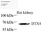 Антитела первичные, поликлональные, DTX4, 100 мкл