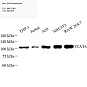 Антитела первичные, поликлональные, STAT6, 100 мкл