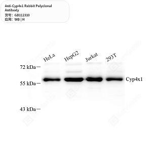 Антитела первичные, поликлональные кролика к Cyp4x1 человека, 50 мкл