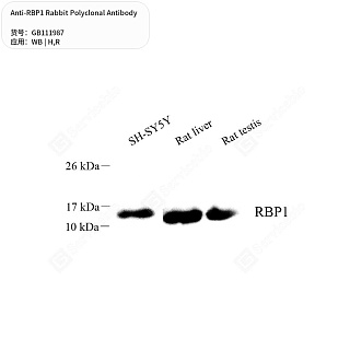 Антитела первичные, поликлональные кролика к RBP1 крысы, человека, 50 мкл