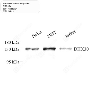 Антитела первичные, поликлональные кролика к DHX30 человека, 50 мкл