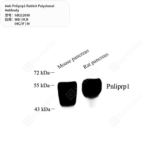 Антитела первичные, поликлональные кролика к Pnliprp1 крысы, мыши, 50 мкл
