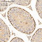 Антитела первичные, поликлональные, ATPase MORC2, 100 мкл