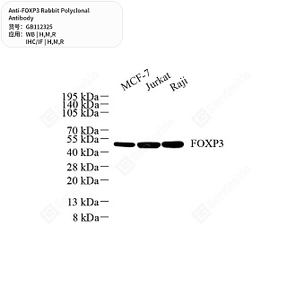 Антитела первичные, поликлональные кролика к FOXP3 крысы, мыши, человека, 50 мкл