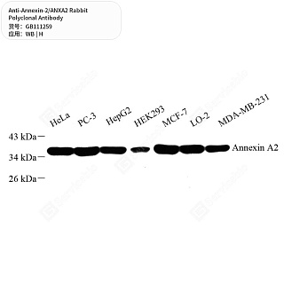 Антитела первичные, поликлональные кролика к Annexin-2/ANXA2 человека, 50 мкл