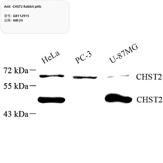 Антитела первичные, поликлональные кролика к CHST2 человека, 100 мкл
