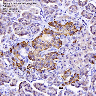 Антитела первичные, поликлональные кролика к GPCR GPR120 крысы, мыши, 50 мкл