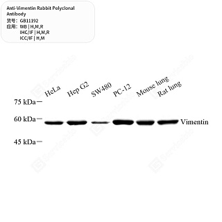 Антитела первичные, поликлональные кролика к Vimentin крысы, мыши, человека, 50 мкл