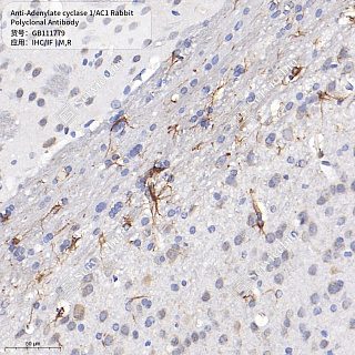 Антитела первичные, поликлональные кролика к Adenylate cyclase 1/AC1 крысы, мыши, 50 мкл