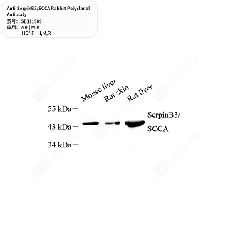 Антитела первичные, поликлональные кролика к SerpinB3/SCCA крысы, мыши, человека, 50 мкл