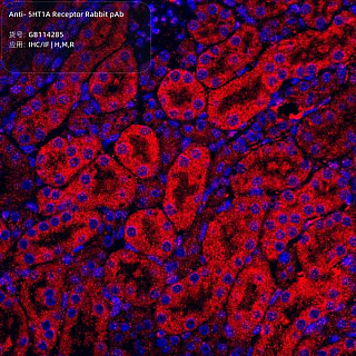Антитела первичные, поликлональные кролика к 5HT1A Receptor крысы, мыши, человека, 100 мкл