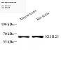 Антитела первичные, поликлональные, KLHL23, 100 мкл