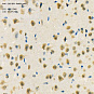Антитела первичные, поликлональные, CUG-BP1, 100 мкл