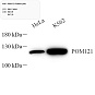 Антитела первичные, поликлональные, POM121, 100 мкл