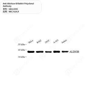 Антитела первичные, поликлональные кролика к Aldolase B крысы, мыши, человека, 50 мкл