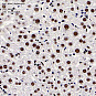 Антитела первичные, поликлональные, HDAC2, 100 мкл