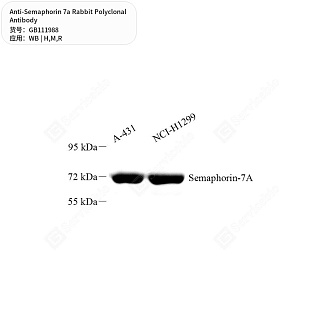 Антитела первичные, поликлональные кролика к Semaphorin 7a крысы, мыши, человека, 50 мкл